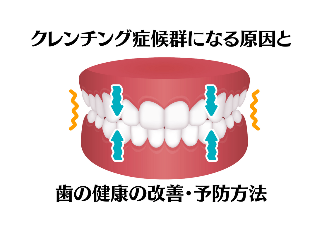 クレンチング症候群になる原因と歯の健康の改善・予防方法